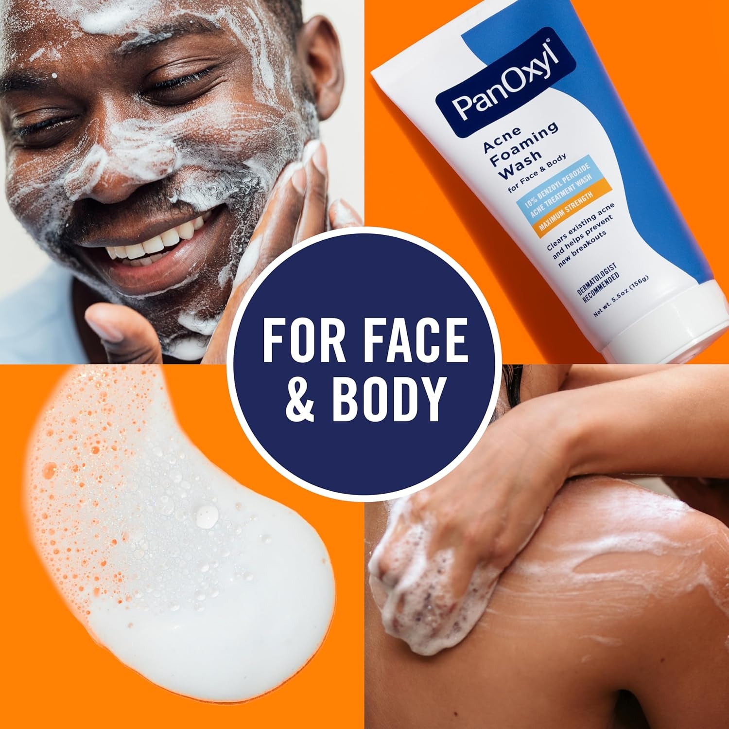 Acne Foaming Wash with Benzoyl Peroxide 