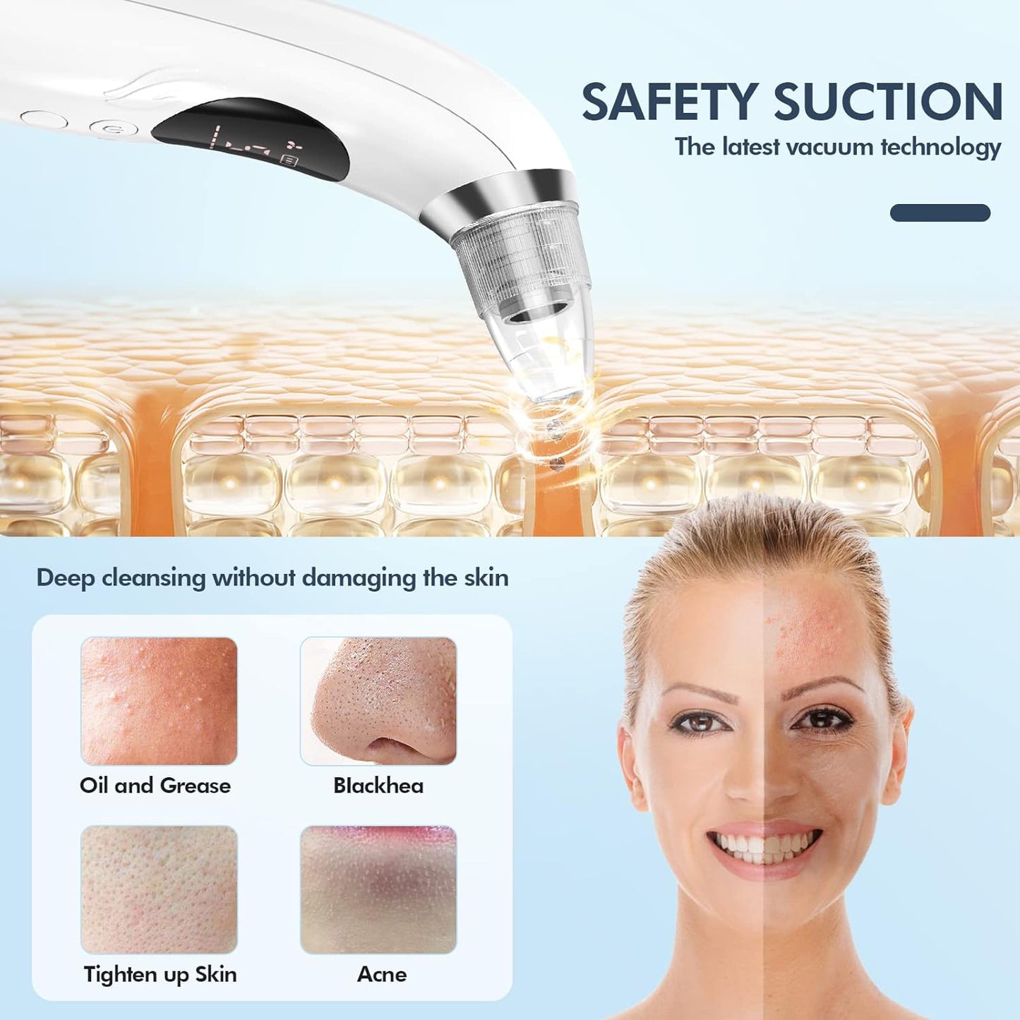  Blackhead Remover Pore Vacuum